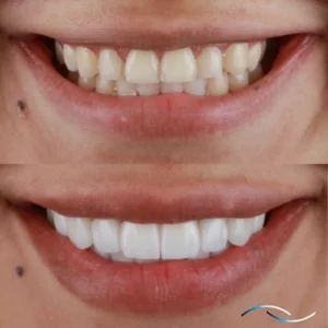 Antes y despues 27