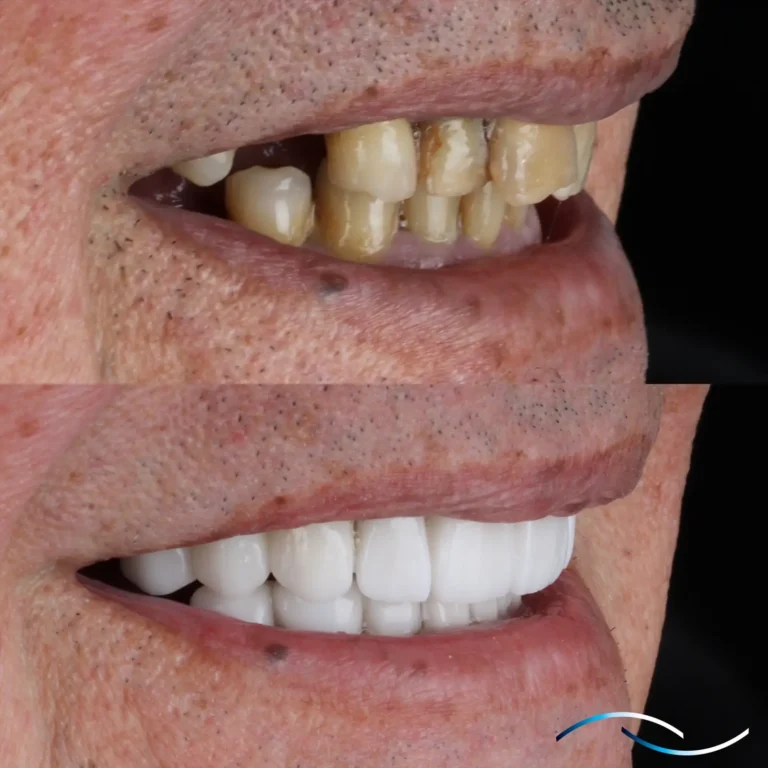 Antes y despues 29