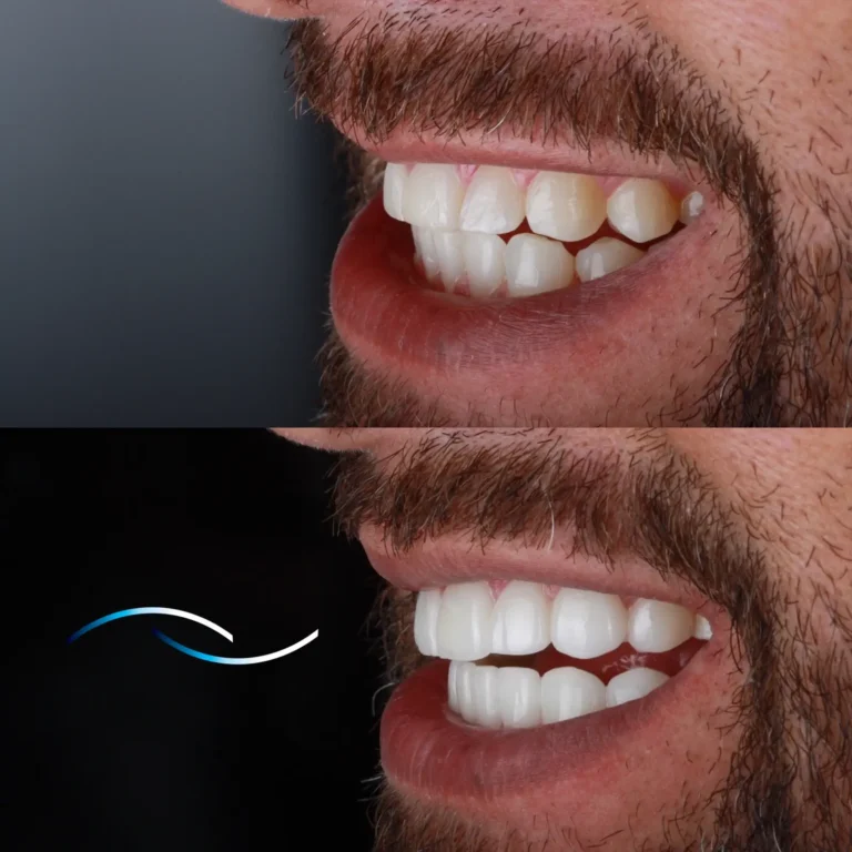Antes y despues 40