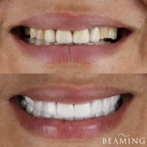 Antes y despues 41