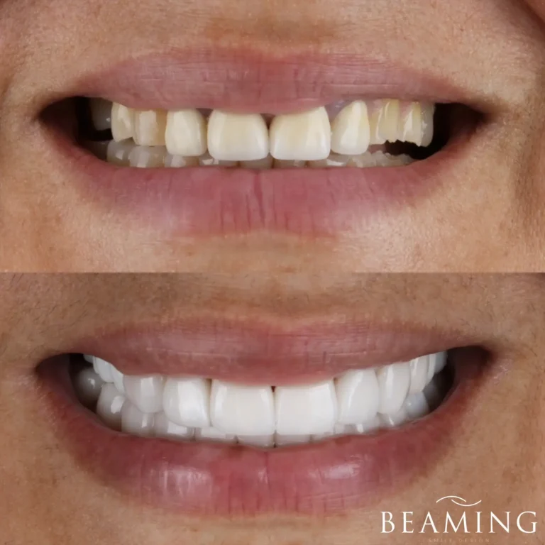 Antes y despues 41