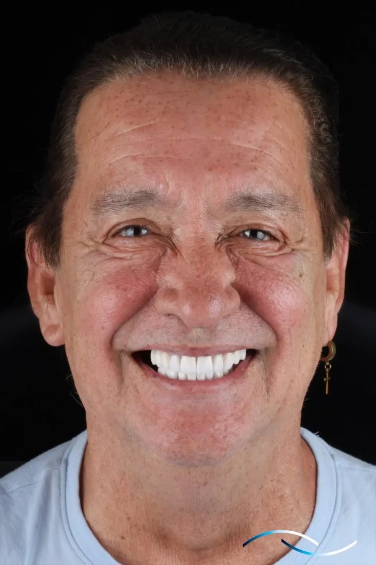 Retratos Beaming 21