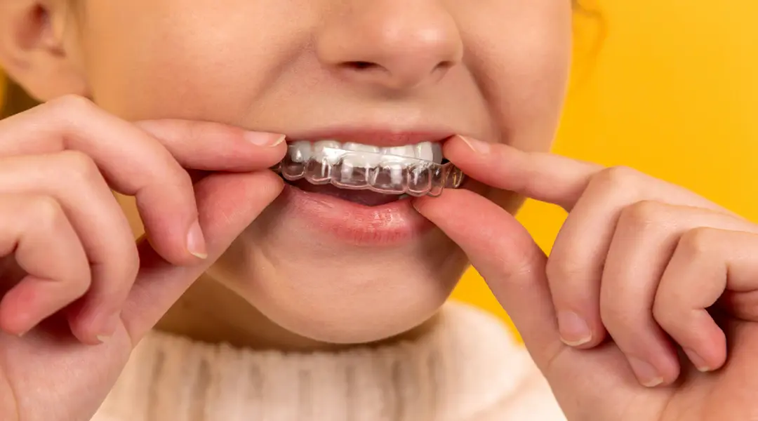 Invisible orthodontics in Medellín: the comfortable and discreet option to transform your smile